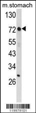 ZFP36 Antibody