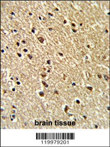 ZFP36 Antibody