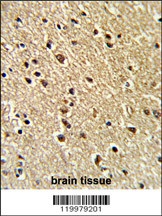 ZNF823 Antibody