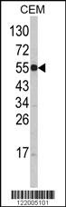 SLC11A1 Antibody