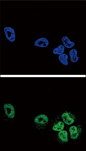 PLA2G4A Antibody