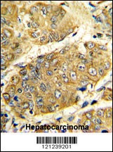 LTA Antibody