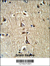 GPD1 Antibody