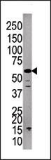 PPP3CC Antibody