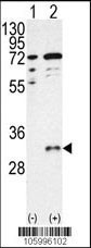 CTDSP1-V250 Antibody