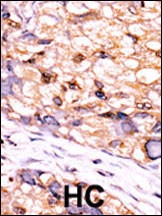 CTDSP1-V250 Antibody