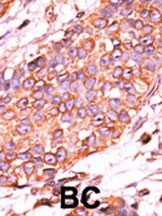 DUSP13-L184 Antibody