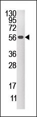 DUSP4 Antibody