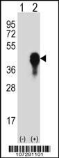 Dusp6 Antibody