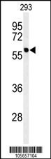 PPM1G Antibody