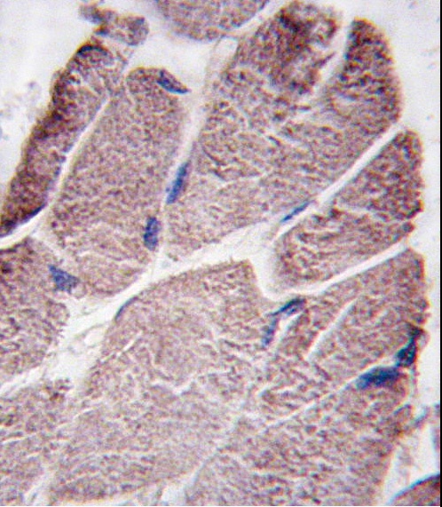 PTPD1 Antibody
