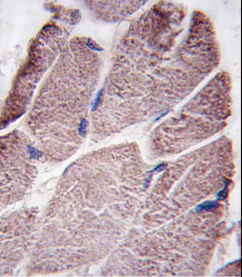 PTPN21 Antibody