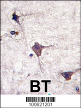 PCPTP1 Antibody