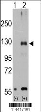 TRPM8 Antibody