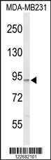 PIK3CG Antibody