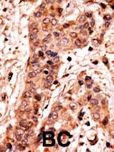 Guanylyl Cyclase alpha 2 Antibody