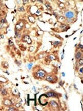BAIAP1 Antibody