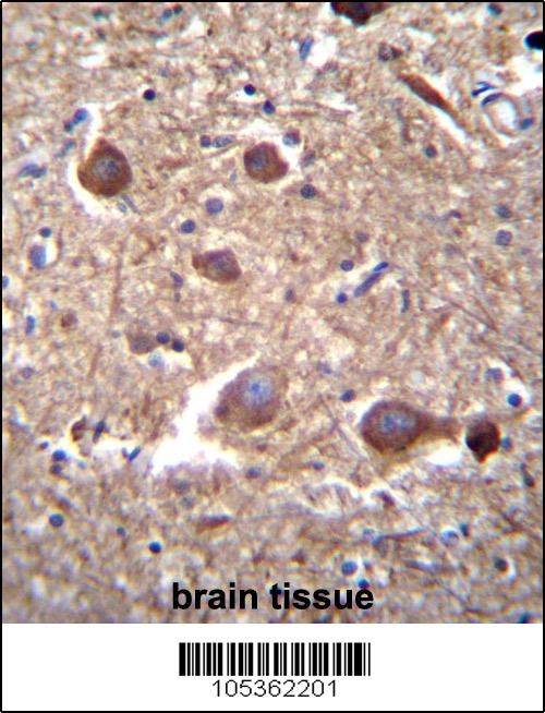 ITPKB Antibody