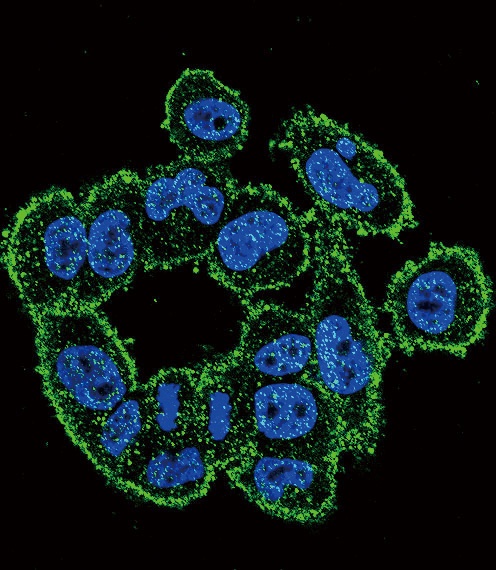 Urokinase Antibody