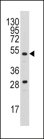 Urokinase Antibody