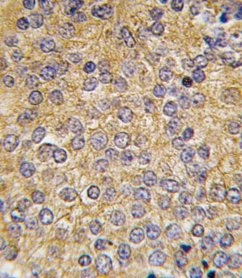 Urokinase Antibody