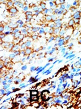 NME4 Antibody