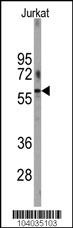 PFKFB1 Antibody