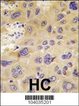 PFKFB1 Antibody