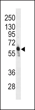 PFKFB3 Antibody