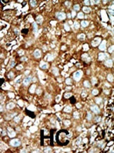 PFKFB3 Antibody