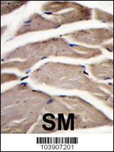Fructose 6 Phosphate Kinase Antibody
