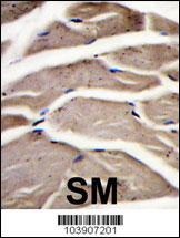 PFKM Antibody