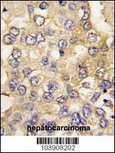 Fructose 6 Phosphate Kinase Antibody