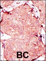 AK3 Antibody