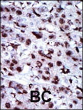 AK5 Antibody