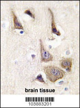 AK5 Antibody