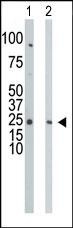 UCK Antibody