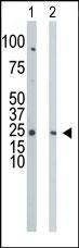 CMPK1 Antibody