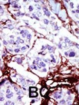 UCK Antibody
