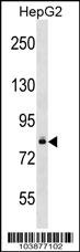 DGKB Antibody