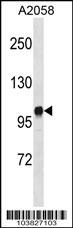 Diacylglycerol kinase iota Antibody