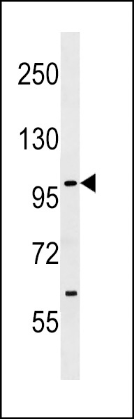 SIK1 Antibody