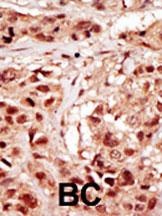 PRPK Antibody