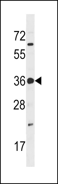 TP53RK Antibody