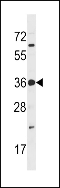 PRPK Antibody