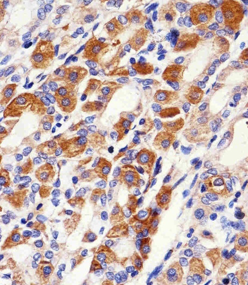 PACSIN2 Antibody