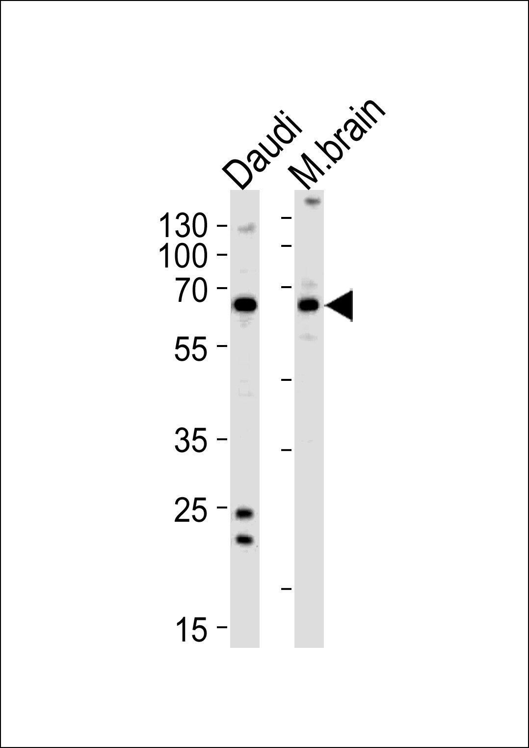 PACSIN2 Antibody