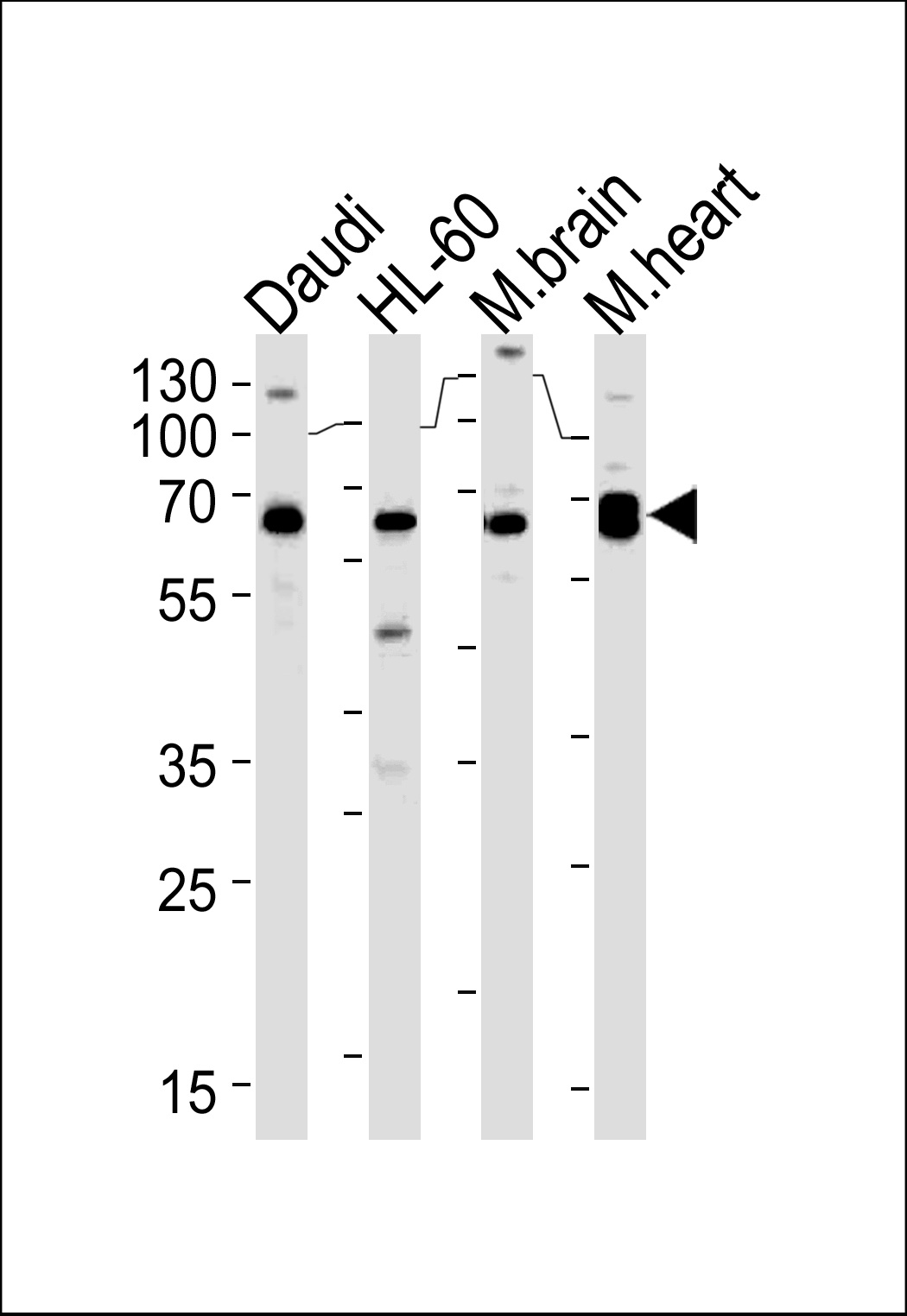 PACSIN2 Antibody