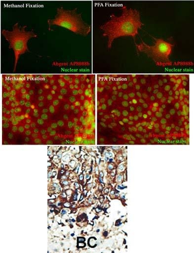 PACSIN2 Antibody