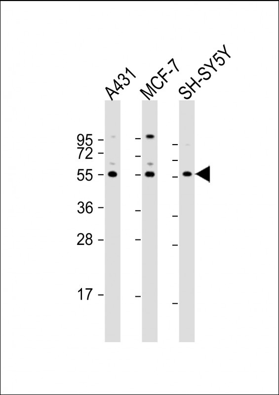 NEK3 Antibody